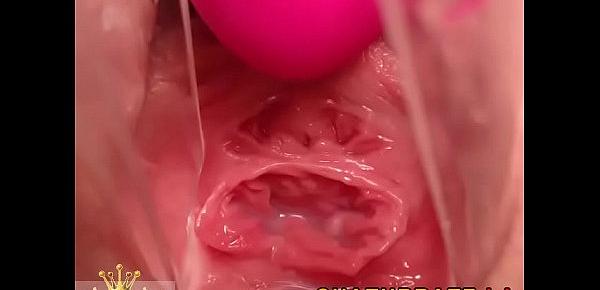  Gyno Cam Close-Up Vagina Cervix Siswet19 — my chat www.girls4cock.comsiswet19